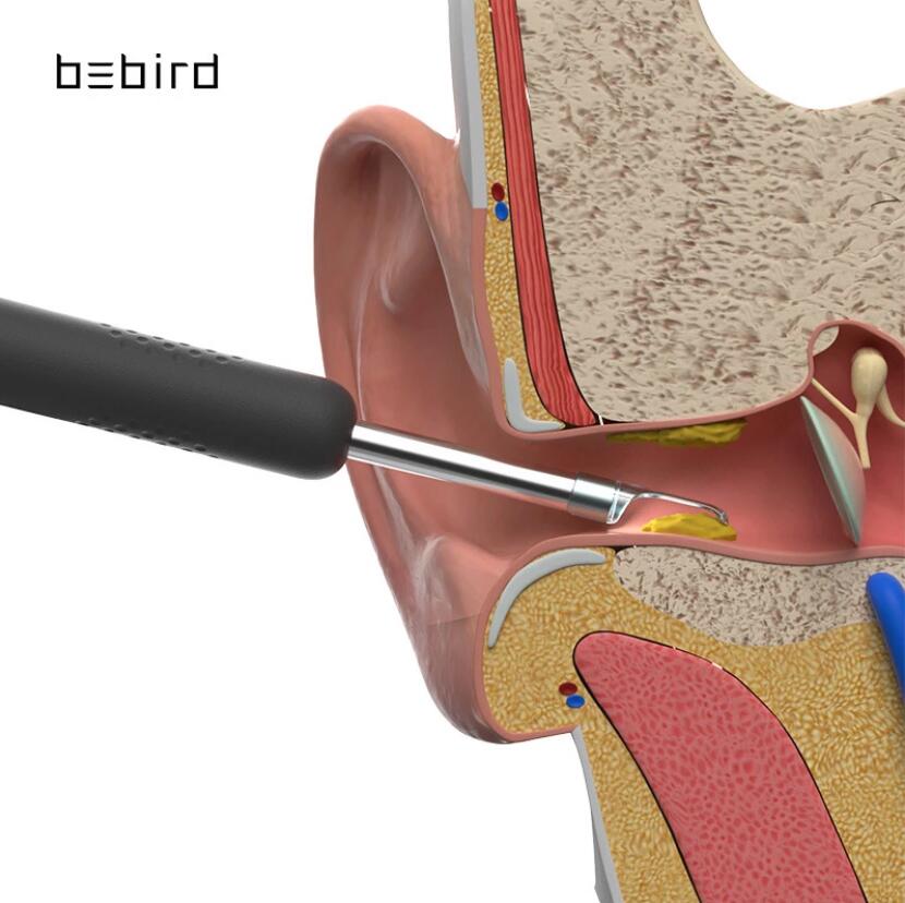 Earwax Cleaner with Camera